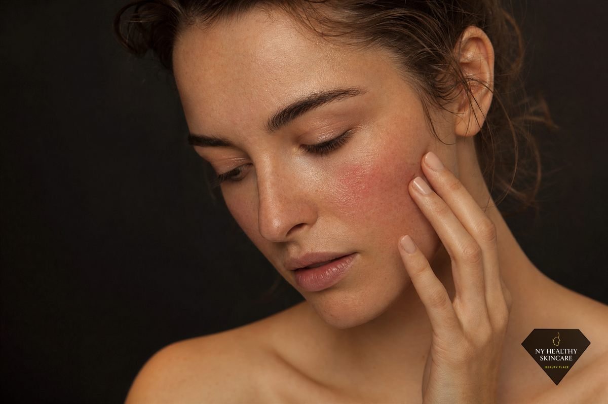 Woman touching sensitive flushed cheek, a warning sign of getting facials too often